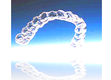 歯列矯正治療 セレライン矯正イメージ